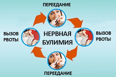 Лечение булимии в Полоцке